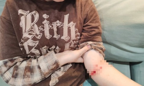 Собака покусала 13-летнего ребенка в сквере на Бору