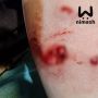 Собака покусала девочку на Бору
