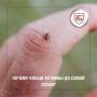 Клещей часто считают «весенней опасностью», но в действительности встретиться с ними можно не только в теплое время года