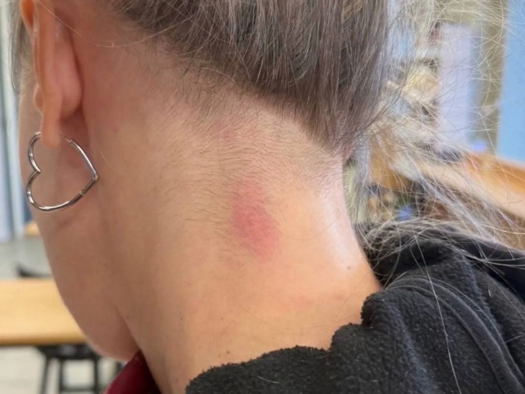 Нижегородцам, в которых стреляли на Мещерском бульваре предположительно пластиковыми пулями, отказали в возбуждении уголовных дел